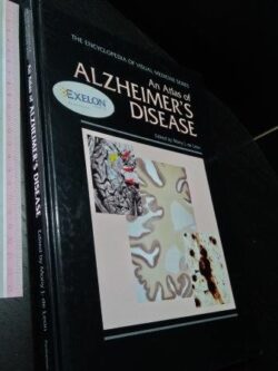 An atlas of alzheimer's disease - Mony J. de Leon